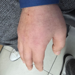 피드에 업로드 된 이미지