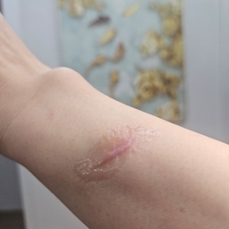 피드에 업로드 된 이미지