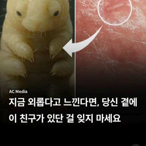 피드 이미지