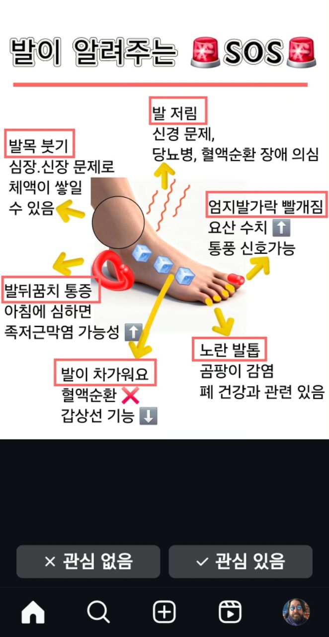 피드 이미지
